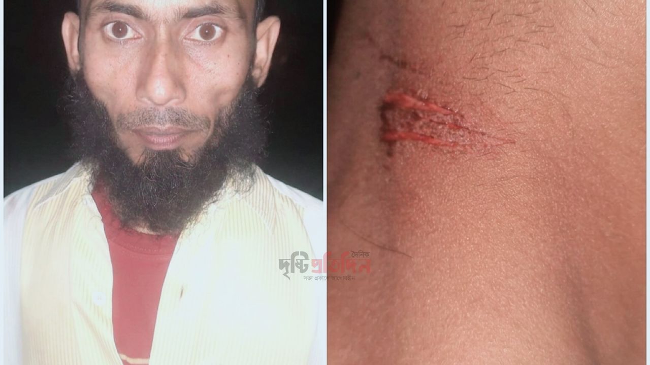 শেরপুরে চালককে অচেতন করে ব্যাটারিচালিত ইজিবাইক ছিনতাই